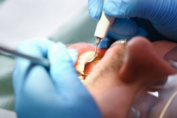 Best Emergency Denture Repair in French Island, WI