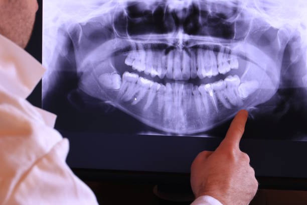 Best Emergency Tooth Extraction in French Island, WI
