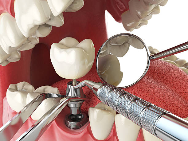 Best Emergency Orthodontic Services in French Island, WI